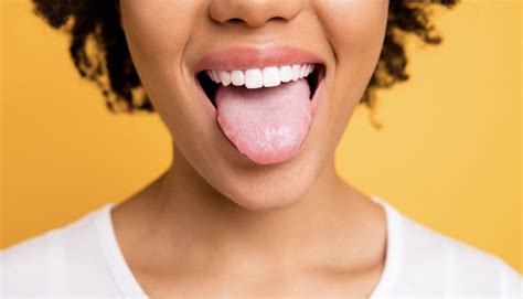 Treating Black Hairy Tongue