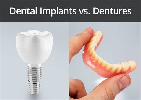 Dental Implant Alternatives Wichita Ks