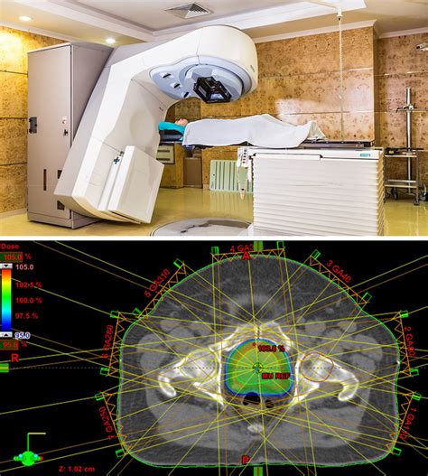 3d Medical Radiation Dose Mapping Ryan P Marchildon