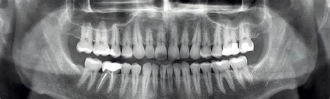 RadiologÍa Clínica Dental Elena Ibáñez