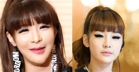 Kpop Idol Plastic Surgery Gone Wrong Terbaru