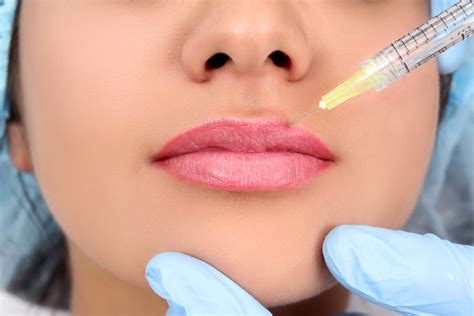 Cosmetic Surgery What Should You Understand Lip Development You