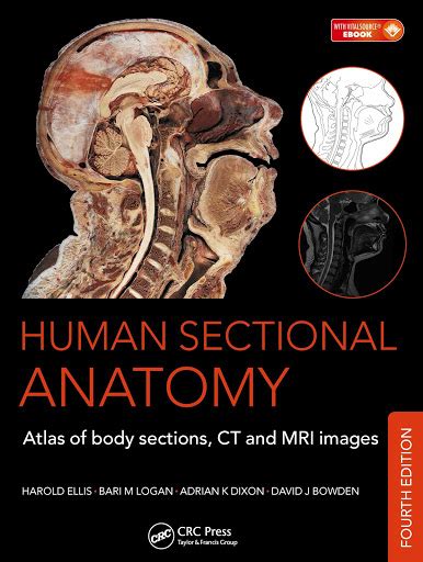 Human Sectional Anatomy Atlas Of Body Sections Ct And Mri Images 4th