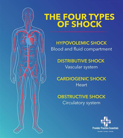 Major Types Of Shock By Nursesnote Nurses Note