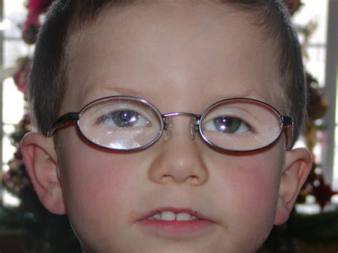 Pictures Of Kids In Glasses With A Strong Prescription For Little Eyes
