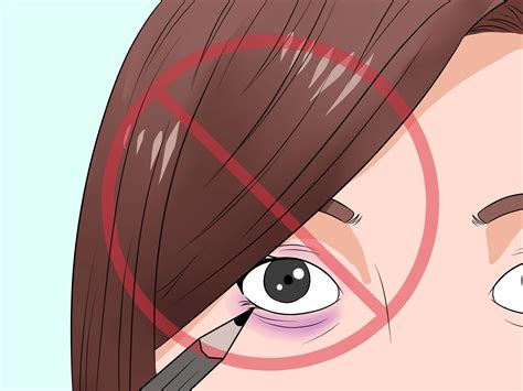Keep your head elevated while sleeping, such as with an extra pillow. 3 Ways to Treat a Black Eye - wikiHow