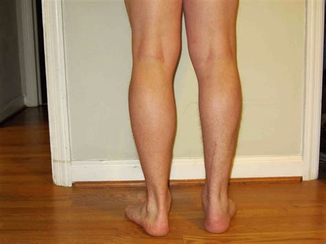 Почему худеют икры ног у женщин причины фото презентация
