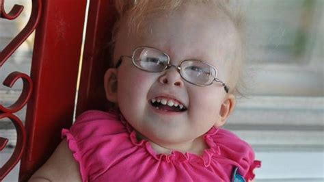 Toddler Overcomes Spine Crushing Dwarfism To Become Internet Singing