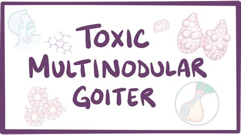 Toxic Multinodular Goiter Video Anatomy And Definition Osmosis