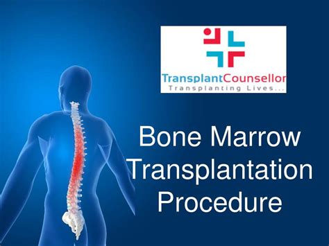 Ppt Bone Marrow Transplantation Procedure Powerpoint Presentation