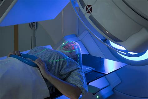Radiotherapy Not Likely To Increase Toxic Effect Of Immune Checkpoint