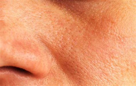 There's something deeply satisfying about feeling that you have fresh, clean skin. 6 Habits That Are Clogging Up Your Pores Like No Other ...