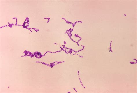 Public Domain Picture A Photomicrograph Of Streptococcus Spp