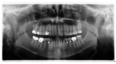 Breakthrough Clinical Oral Pathology Case No 33 Dentistry Iq