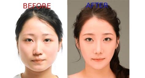Plastic Surgery Is Actually A Very Common Korean Gift