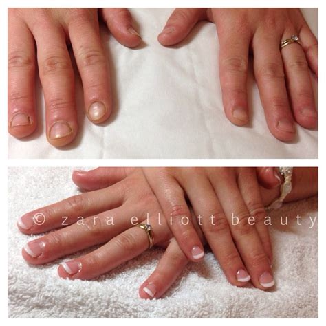 Before And After On Bitten Nails Biosculpture Gel See Services