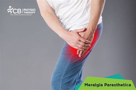 What Is Meralgia Paresthetica Symptoms Causes Diagnosis