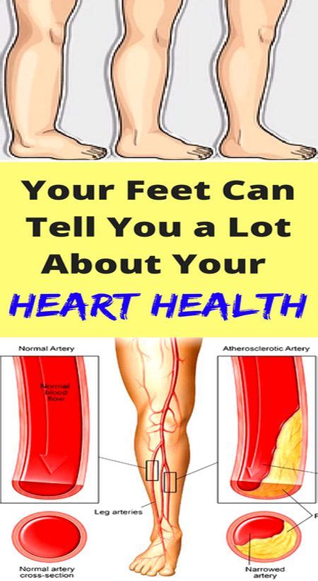 Your Feet Can Tell You A Lot About Your Heart Health Heart Health