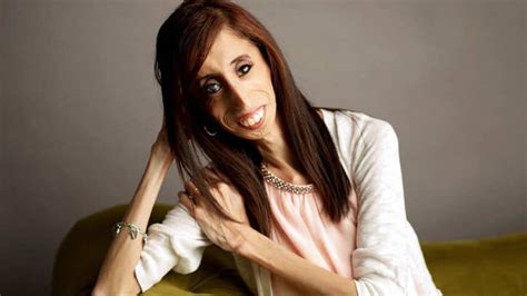 ‘worlds Ugliest Woman Now Inspires People All Over The Globe With Her ‘true Beauty