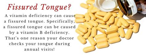 Main Causes Of The Fissured Tongue