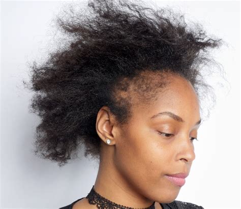 Hair growth solutions for black women is the board to get all of your hair growth tips to grow your hair healthy and long. What Black Women Need to Know About Hair Loss - The New ...