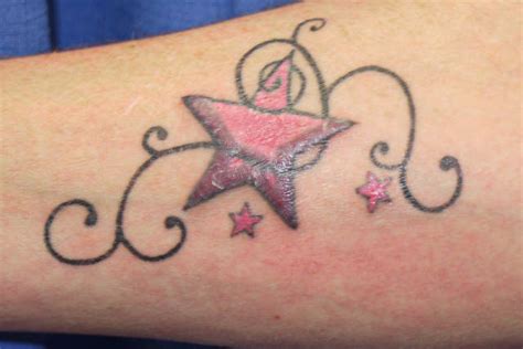 Infected Tattoo Stages Signs Treatment What To Expect
