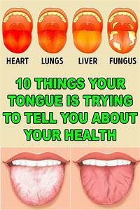 What Your Tongue Says About Your Health Health Health Heal