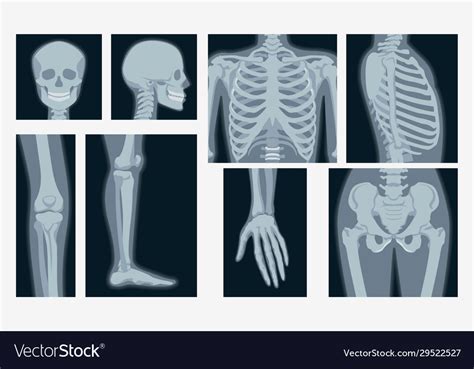 X Ray Clip Art Vector And Illustration X Ray Clipart Vector Eps My