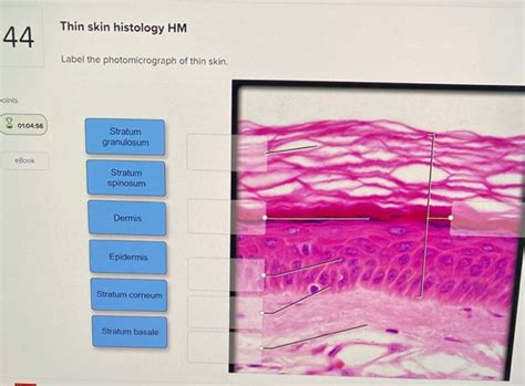Get Answer Thin Skin Histology Hm 44 Label The Photomicrograph Of