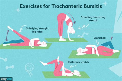 What To Expect From Trochanteric Bursitis Physical Therapy 2022