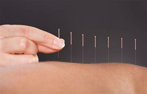 Eczema And Acupuncture A Sound Solution Part 1 Acupuncture Today