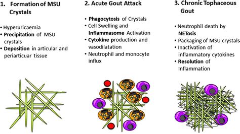Why Does The Gout Attack Stop A Roadmap For The Immune Pathogenesis Of