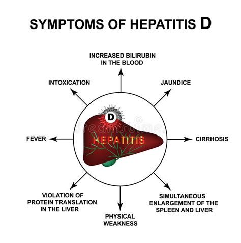 Being sick to your stomach. Symptome von Hepatitis a vektor abbildung. Illustration ...