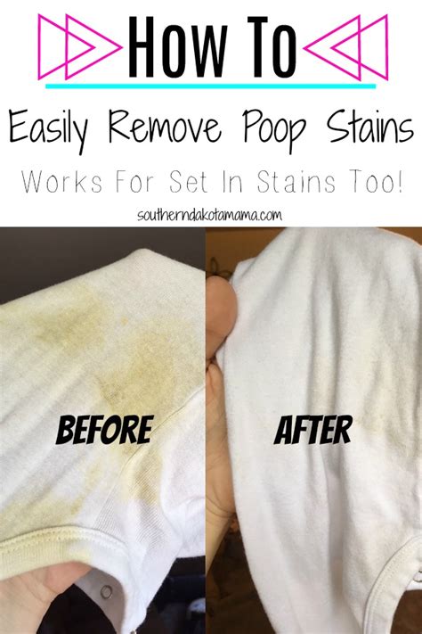 The Best Way To Remove Baby Poop Stains Southern Dakota Mama