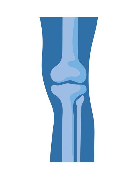 Normal Knee Bones 2748916 Vector Art At Vecteezy