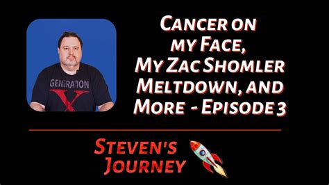 Cancer On My Face My Zac Shomler Meltdown And More Steven Shomlers