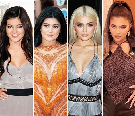 kardashian jenners plastic surgery before and after photos