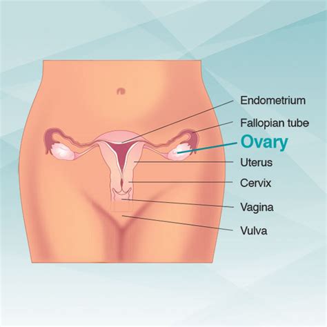 Diagram Of Ovary Betty Allen Gynecologic Cancer Foundation