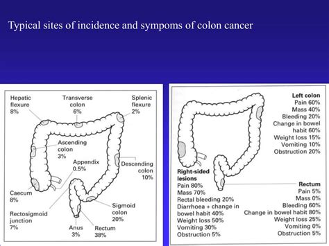 Ppt Colorectal Cancer Crc Powerpoint Presentation Id66087
