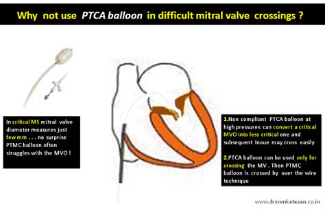 10:53 structural heart disease australia 5 641 просмотр. ptmc | Dr.S.Venkatesan MD