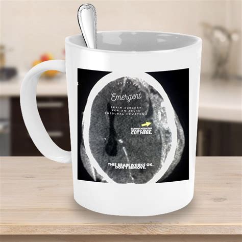 'we've got to be very clear that we are now at the worst point of this epidemic for the uk,' he told bbc breakfast. Amazon.com: Whimsical, witty, & quirky x-ray novelty mugs ...