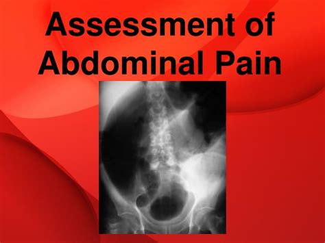 Ppt Assessment Of Abdominal Pain Powerpoint Presentation Free