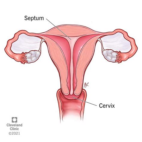 Set Of Uterine Septum Septate Uterus Female Reproductive System Diagram