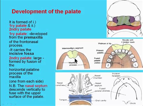 16 Development Of The Palate Youtube