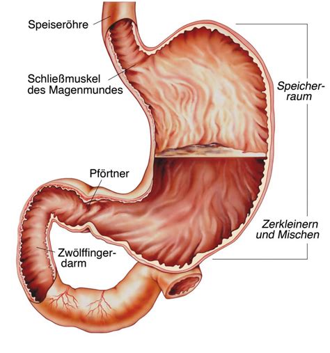 The cause is typically a viral or bacterial infection. Gastritis (Magenschleimhautentzündung) - Symptome ...