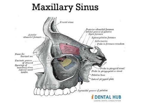 Pressure In Right Maxillary Sinus Dental Care Identalhub