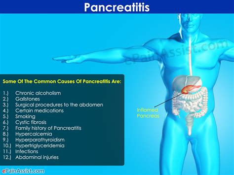 What Causes Pancreatic Pain Cares Healthy