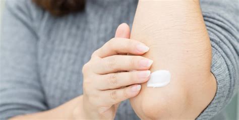 Heres Everything You Need To Know About Atopic Dermatitis By A