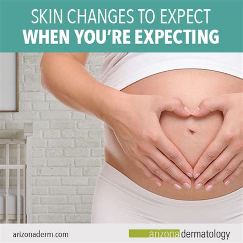 Skin Changes To Expect When Youre Pregnant
