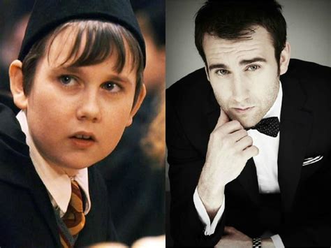15 Hot Celebrities Who Grew Up As The Ugly Duckling